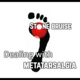 Dealing with metatarsalgia (stone bruising)